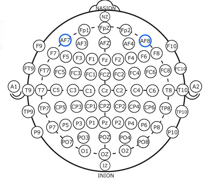 脑电头环通道示意图